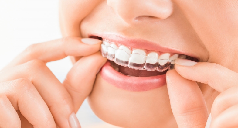Understanding the Long-Term Benefits of Orthodontic Care